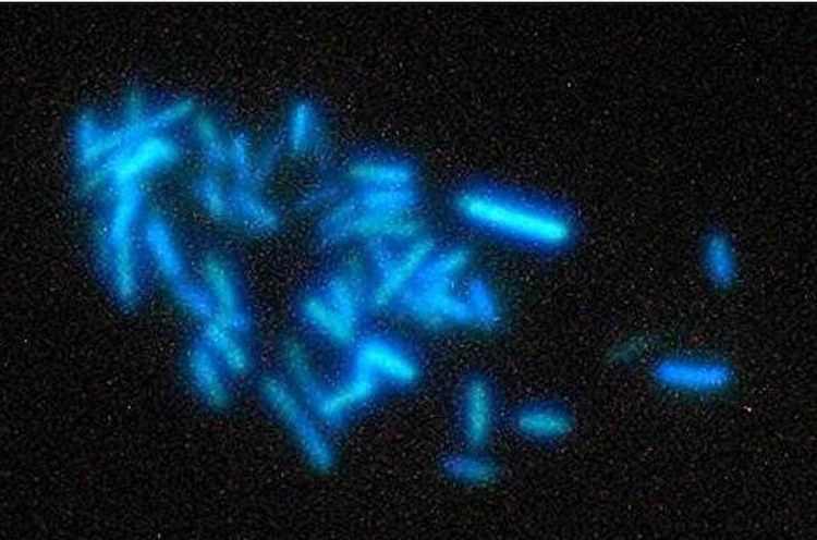 Archaea idrogenotrofe viste al microscopio