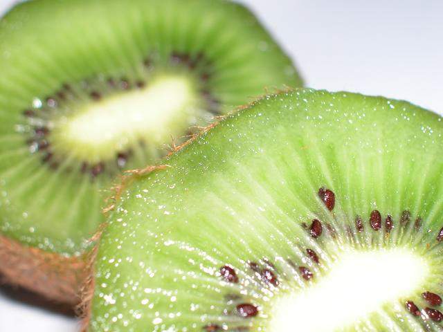 Il kiwi, alimentazione e benessere